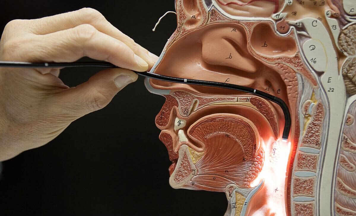 Modello anatomico di sezione della faccia, Il medico introduce la telecamera nel naso per esplorare il naso, la faringe e la laringe